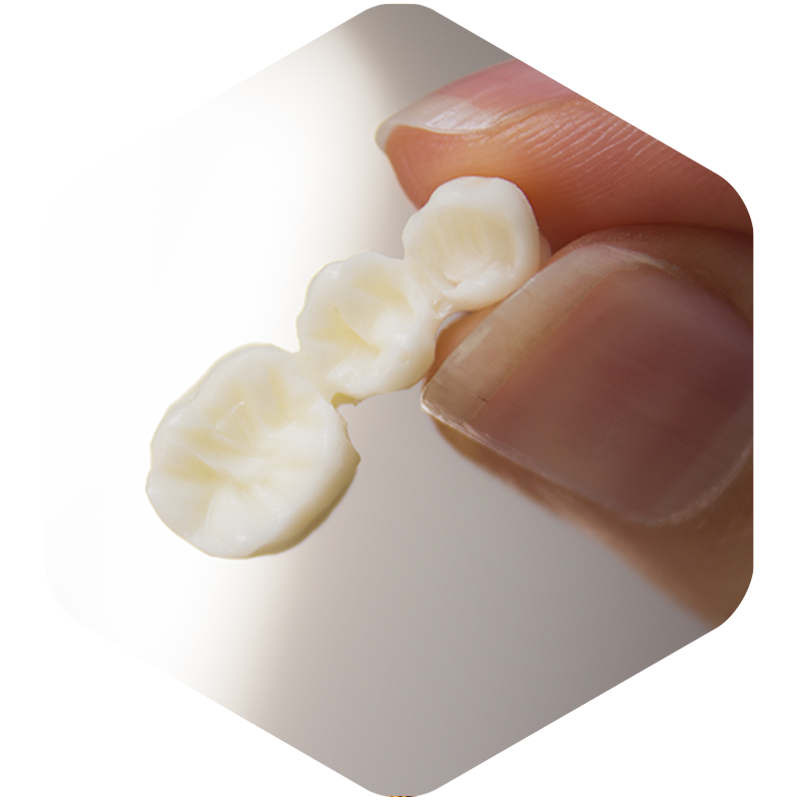 Dentist holding dental bridge